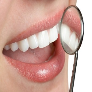 Feb-UC-001-White-Teeth1